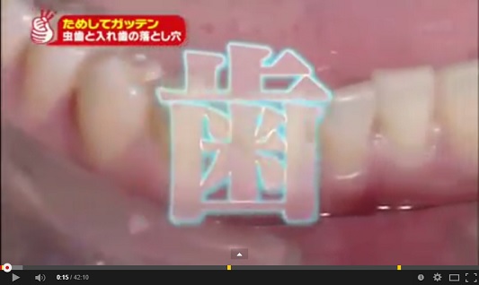 ためしてガッテン　2月11日　虫歯＆入れ歯　動画.jpg